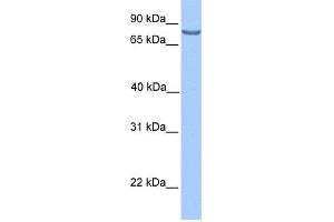 WB Suggested Anti-LCA5 Antibody Titration: 0. (LCA5 anticorps  (N-Term))