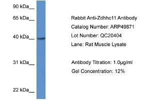 Western Blotting (WB) image for anti-Zinc Finger, DHHC-Type Containing 11 (ZDHHC11) (Middle Region) antibody (ABIN2783945) (ZDHHC11 anticorps  (Middle Region))