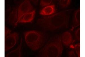Immunofluorescence staining of methanol-fixed MCF7 cells using Her3/ErbB3(phospho-Tyr1328) Antibody. (ERBB3 anticorps  (pTyr1328))