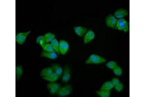 Immunofluorescence staining of Hela cells with ABIN7160664 at 1:100, counter-stained with DAPI. (MYOZ2 anticorps  (AA 90-180))