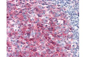 Tonsil: Formalin-Fixed, Paraffin-Embedded (FFPE)