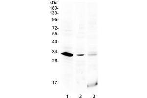 Western blot testing of 1) rat testis, 2) mouse testis and 3) human MCF7 lysate with HOXB1 antibody at 0.