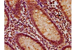 IHC image of ABIN7158363 diluted at 1:200 and staining in paraffin-embedded human appendix tissue performed on a Leica BondTM system.