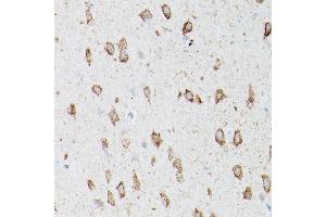 Immunohistochemistry of paraffin-embedded mouse brain using L1 Rabbit pAb (ABIN6134555, ABIN6137248, ABIN6137250 and ABIN6215529) at dilution of 1:100 (40x lens).