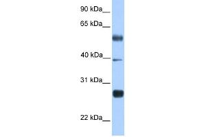 WB Suggested Anti-MXD3 Antibody Titration:  0. (MXD3 anticorps  (N-Term))
