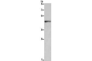 Western Blotting (WB) image for anti-Interleukin 5 Receptor, alpha (IL5RA) antibody (ABIN5549967) (IL5RA anticorps)