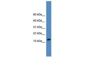 Western Blot showing SLPI antibody used at a concentration of 1-2 ug/ml to detect its target protein. (SLPI anticorps  (N-Term))
