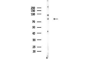 anti-Activating Transcription Factor 6 beta (ATF6B) (Internal Region) antibody