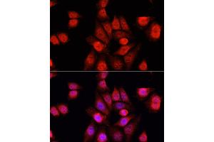 Immunofluorescence analysis of HeLa cells using RBFOX3 antibody (ABIN1874561) at dilution of 1:100. (NeuN anticorps)
