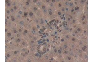 Detection of CD2AP in Rat Liver Tissue using Polyclonal Antibody to CD2 Associated Protein (CD2AP) (CD2AP anticorps  (AA 368-623))