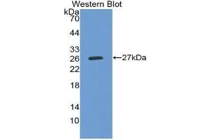Western blot analysis of the recombinant protein. (Prekallikrein anticorps  (AA 156-364))
