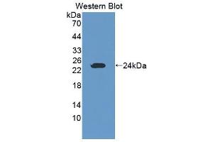 Western blot analysis of the recombinant protein. (GZMK anticorps  (AA 44-227))