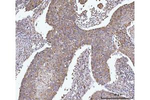 IHC analysis of AGPS using anti-AGPS antibody (ABIN7600146). (AGPS anticorps  (AA 154-658))