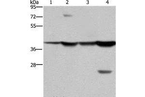 Western Blot analysis of Mouse stomach and Human fetal liver tissue, MCF-7 cell and Mouse liver tissue using FBP1 Polyclonal Antibody at dilution of 1:850 (FBP1 anticorps)