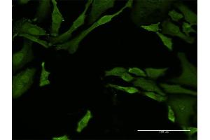 Immunofluorescence of monoclonal antibody to TNFRSF21 on HeLa cell. (TNFRSF21 anticorps  (AA 1-472))