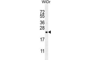 Western Blotting (WB) image for anti-Family with Sequence Similarity 237 Member A (FAM237A) antibody (ABIN3004576) (FAM237A anticorps)
