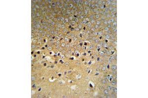 Immunohistochemistry (IHC) image for anti-Von Hippel-Lindau Tumor Suppressor, E3 Ubiquitin Protein Ligase (VHL) antibody (ABIN2905637)