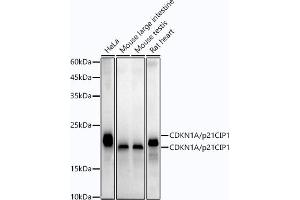 Western blot analysis of extracts of various cell lines, using CDKN1A/p21CIP1 antibody (ABIN7266599) at 1:1000 dilution.
