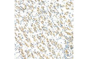 Immunohistochemistry analysis of paraffin-embedded mouse fetal rat using GBA (ABIN7074062) at dilution of 1: 2000 (GBA anticorps)