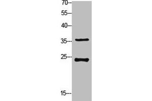 Western Blot analysis of customer's (cat sample) using Ribosomal Protein S4X Polyclonal Antibody (RPS4X anticorps  (Internal Region))