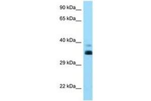 Image no. 1 for anti-HLA Class I Histocompatibility Antigen, alpha Chain G (HLAG) (AA 216-265) antibody (ABIN6748180)