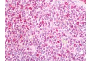 Human Tonsil: Formalin-Fixed, Paraffin-Embedded (FFPE).