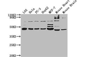 Western Blot Positive WB detected in: L02 whole cell lysate, Hela whole cell lysate, PC-3 whole cell lysate, HepG2 whole cell lysate, MCF-7 whole cell lysate, Mouse Heart tissue, Mouse Brain tissue All lanes: NOB1 antibody at 1:2000 Secondary Goat polyclonal to rabbit IgG at 1/50000 dilution Predicted band size: 47 kDa Observed band size: 47 kDa