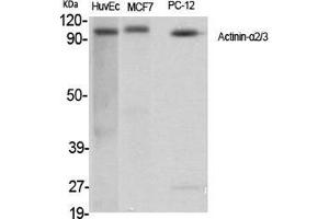 Western Blot (WB) analysis of specific cells using Actinin-alpha2/3 Polyclonal Antibody. (ACTN2/3 anticorps  (N-Term))