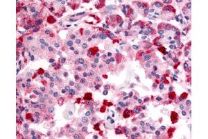 Anti-TRPM4 antibody IHC of human pancreas.