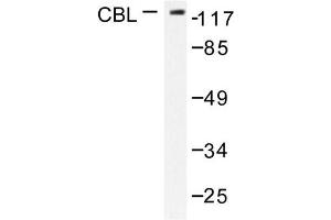 Image no. 1 for anti-Cas-Br-M (Murine) Ecotropic Retroviral Transforming Sequence (CBL) antibody (ABIN271926) (CBL anticorps)