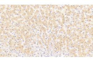 Detection of PSA in Human Liver Tissue using Polyclonal Antibody to Puromycin Sensitive Aminopeptidase (PSA)