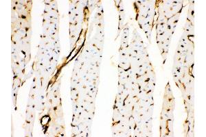 Anti- Annexin A3 Picoband antibody, IHC(P) IHC(P): Rat Cardiac Muscle Tissue (Annexin A3 anticorps  (Middle Region))
