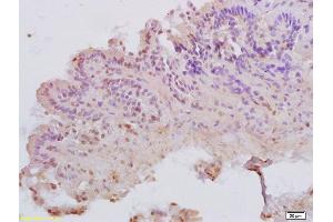 Formalin-fixed and paraffin embedded rat colitis tissue labeled with Anti-MATH1 Polyclonal Antibody, Unconjugated (ABIN747593) at 1:200 followed by conjugation to the secondary antibody and DAB staining (ATOH1 anticorps  (AA 145-250))