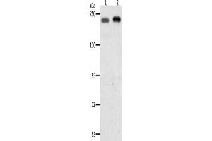 Western Blotting (WB) image for anti-SWI/SNF Related, Matrix Associated, Actin Dependent Regulator of Chromatin, Subfamily A, Member 4 (SMARCA4) antibody (ABIN2431119)