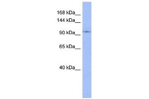 WB Suggested Anti-DDX26B Antibody Titration:  0. (DDX26B anticorps  (N-Term))