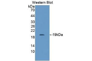 Detection of Recombinant IL11Ra, Mouse using Polyclonal Antibody to Interleukin 11 Receptor Alpha (IL11Ra) (IL11RA anticorps  (AA 59-217))