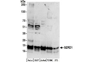 anti-Chromosome 1 Open Reading Frame 144 (C1orf144) (AA 102-152) antibody