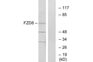 Western blot analysis of extracts from Jurkat cells, using FZD8 antibody. (FZD8 anticorps  (C-Term))