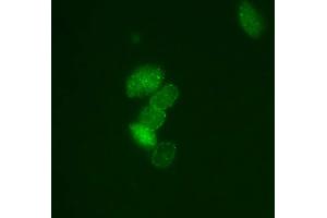 Immunofluorescence (IF) image for anti-Small Ubiquitin Related Modifier Protein 1 (SUMO1) (full length) antibody (ABIN2452138) (SUMO1 anticorps  (full length))
