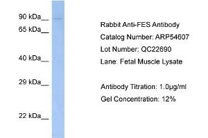 Western Blotting (WB) image for anti-Feline Sarcoma Oncogene (FES) (N-Term) antibody (ABIN2785795) (FES anticorps  (N-Term))
