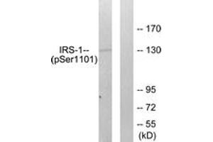 Western blot analysis of extracts from COS7 cells treated with Calyculin A 50ng/ml 30', using IRS-1 (Phospho-Ser1101) Antibody. (IRS1 anticorps  (pSer1101))