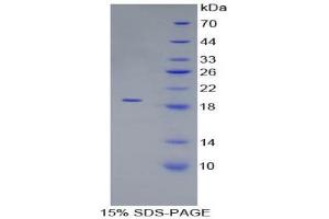 SDS-PAGE (SDS) image for Peroxiredoxin 5 (PRDX5) (AA 49-210) protein (His tag) (ABIN2121844)