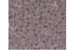 DAB staining on IHC-P; Samples:Mouse Liver Tissue