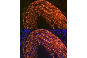 Immunofluorescence analysis of mouse large intestine using Calponin Rabbit mAb (ABIN1678670, ABIN3018018, ABIN3018019 and ABIN7101568) at dilution of 1:100 (40x lens).