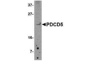 Image no. 1 for anti-Programmed Cell Death 5 (PDCD5) (N-Term) antibody (ABIN341739) (PDCD5 anticorps  (N-Term))