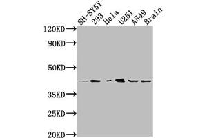 Western Blot Positive WB detected in: SH-SY5Y whole cell lysate, 293 whole cell lysate, Hela whole cell lysate, U251 whole cell lysate, A549 whole cell lysate, Mouse brain tissue All lanes: OPRD1 antibody at 1:2000 Secondary Goat polyclonal to rabbit IgG at 1/50000 dilution Predicted band size: 41 kDa Observed band size: 41 kDa (Recombinant OPRD1 anticorps)