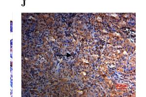 Expression of SPARC in human ovarian tissues using antibody AF941 and bs-1133R.