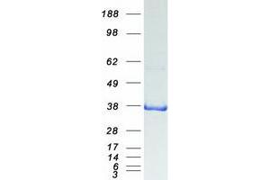 Validation with Western Blot