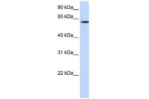 FBXO24 antibody used at 1 ug/ml to detect target protein.