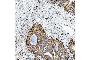 IHC analysis of GPCR RDC1/CXCR-7/ACKR3 using anti-GPCR RDC1/CXCR-7/ACKR3 antibody (ABIN7602889). (CXCR7 anticorps  (C-Term))